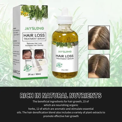 Hair Growth Essence Oil Hair Loss Oil Repair 60ml Hairs Growth Serums Dry Damaged Hairs Care Oils for Women  Men All Hair Types