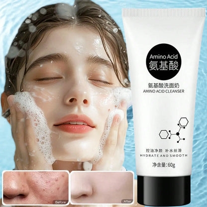 Amino Moisturizes Acid Facial Cleanser Deeply Cleans Dirt Controls Oil Enriches Foam