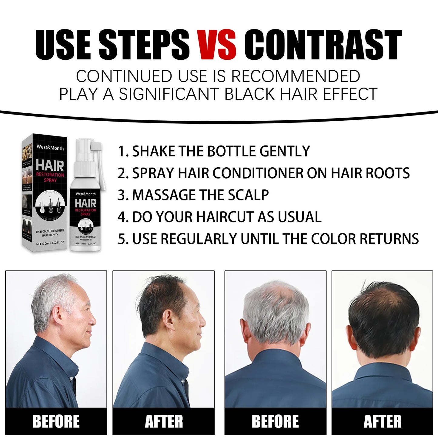 Anti White Hair Spray Treatment Serum Hair Growth Spray Restoration Black Hair Anti Hair Loss Repair Hair Loss Product 30ML
