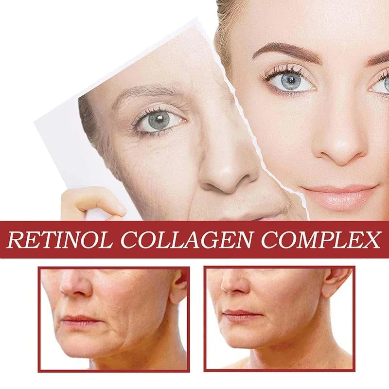 Retinol Eye Cream Collagen Multibalm Stick Reduce Wrinkles Eye Bag Hyaluronic Acid Anti Dark Circle Puffiness Eye Care Products