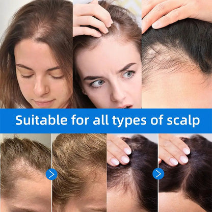 Seapuri Scalphy Hair Care Essence Scalp Clean Cooling & Refreshing Hair Essence Hair Fast Growth Strengthening Hair Care Essence