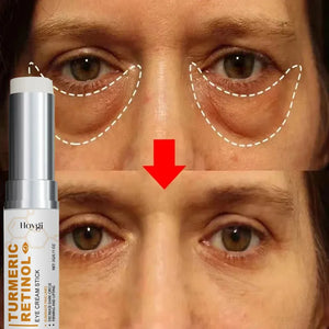 Instant Eye Bag Remove Eye Cream Anti Fat Particles Dark Circles Puffiness Fade Fine Lines Lift Brighten Korean Beauty Eye Care