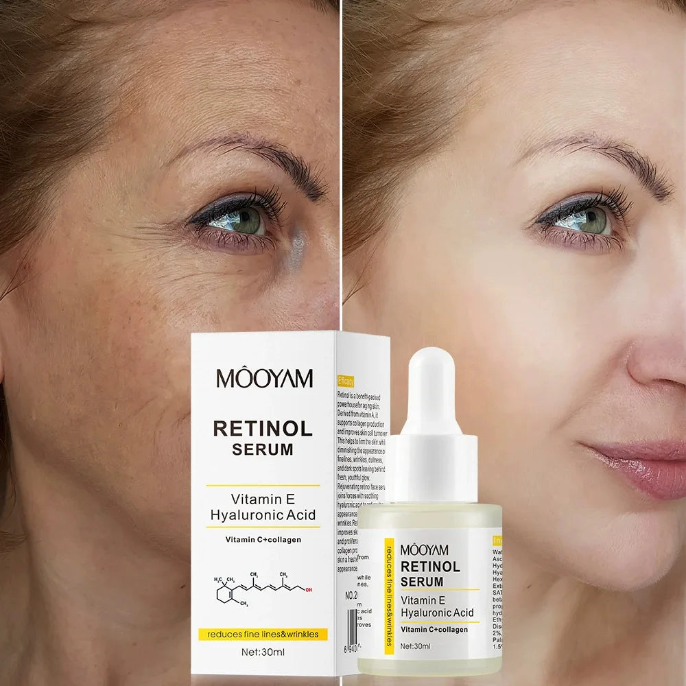 Retinol Facial Essence 2.5% with Hyaluronic Acid VE Anti-Aging Serum for Smooth Skin And Acne Treatment face Reduces Wrinkles