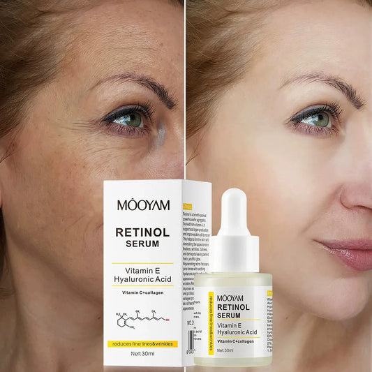 Retinol Facial Essence 2.5% with Hyaluronic Acid VE Anti-Aging Serum for Smooth Skin And Acne Treatment face Reduces Wrinkles