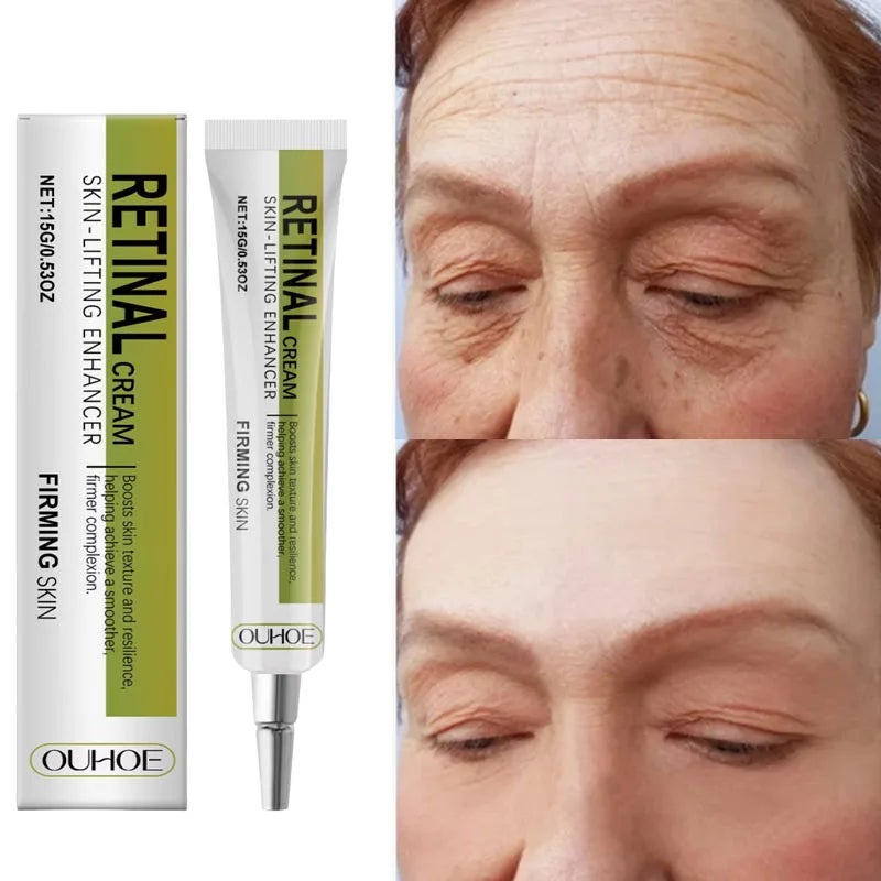 Retinol Cream Tightening Anti Wrinkle Improve Sagging Moisturizing Smoothing Lightening Firming Radiant Fine Lines Removal Cream