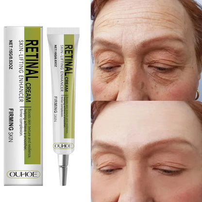 Retinol Cream Tightening Anti Wrinkle Improve Sagging Moisturizing Smoothing Lightening Firming Radiant Fine Lines Removal Cream