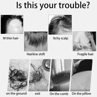 Ginger Hair Growth Essential Oil Herbal Hair Care Anti-Hair Loss Repair Hair Follicles Stimulate Hair Growth