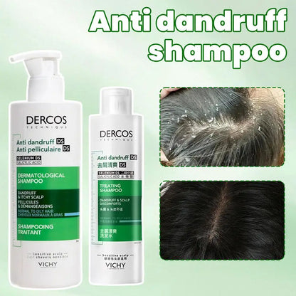 Dercos Oil-Control Shampoo Removes Dandruff Repairs Damaged Hair Improves Scalp Environment For Hair Care
