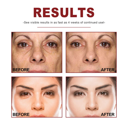 Retinol Serum Hydrating Brightening Gentle for All Skin Types Smooth Texture Non Greasy Daily for All Skin Types Daily Hydration