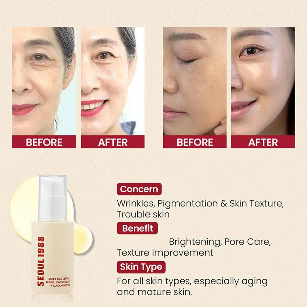 30ml Seoul 1988 Retinol Ginseng Essence Eye Face Cream Moisturizing Niacinamide Brightening Anti-aging Say Goodbye To Wrinkles