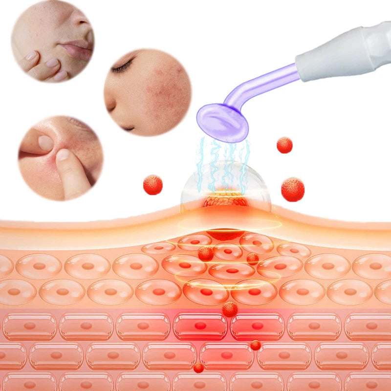 Replace HF Wand Spiral Electrode Glass Tube Argon Violet Ray Neon Acne Skin Care Face Body Massage