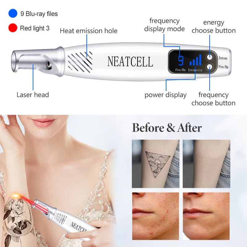 Picosecond Laser Pointer for Mole Removal  Dark Spot Removal Pen Tattoo Acne Skin Pigment Portable Removal Machine Beauty Device