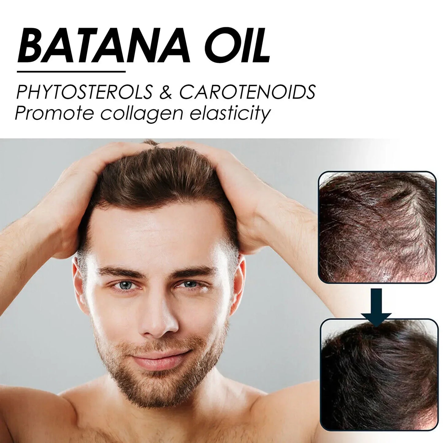 30ml African Batana Oil Hair Growth Spray Fast Repair Baldness Hereditary Postpartum Seborrheic Hair Loss Treatment Serum