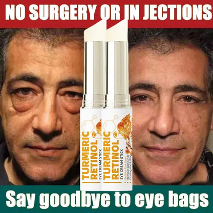 Instant Eye Bag Remove Eye Cream Anti Fat Particles Dark Circles Puffiness Fade Fine Lines Lift Brighten Korean Beauty Eye Care