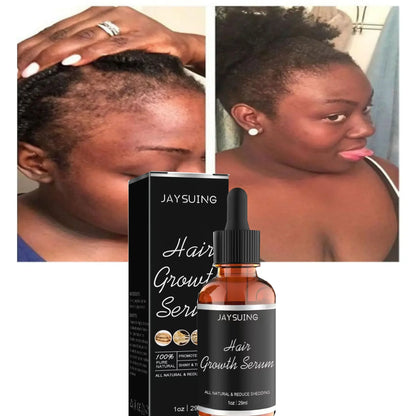 Hair care essence has good permeability, penetrates into the hair core, fully absorbs nutrients, and deeply moisturizes