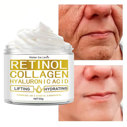 Retinol, Collagen& Hyaluronic Acid Cream - Anti-Aging Face Moisturizer for Face, Neck & Décolleté - Daily Moisturizer Face Cream
