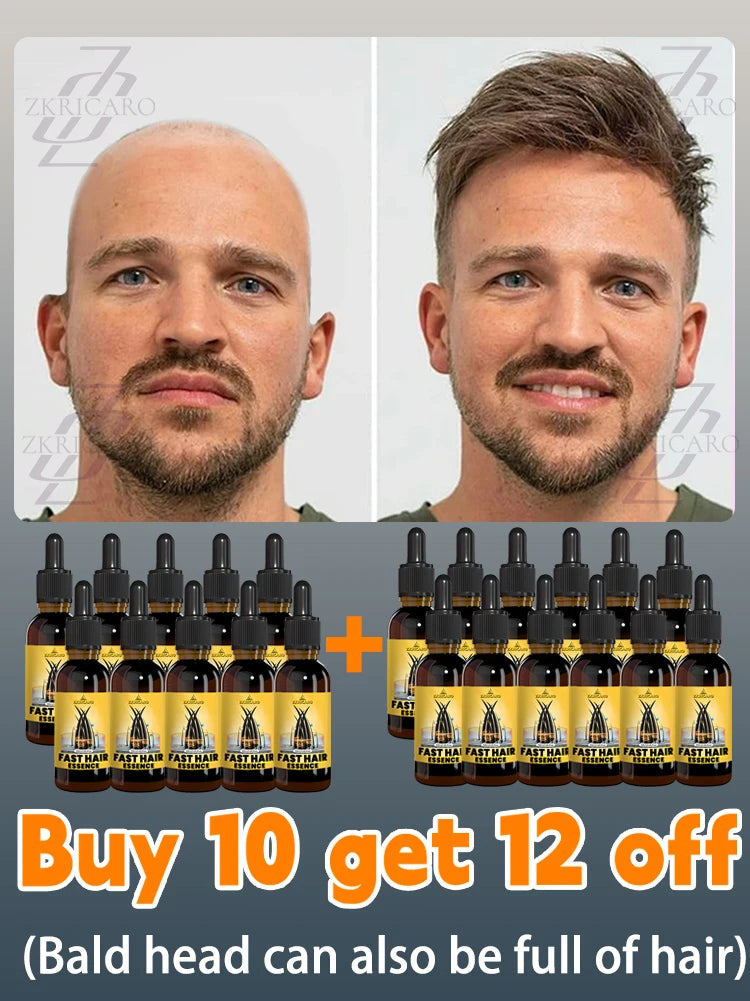 2025 bestseller, Hair growth oil for men, accelerates hair growth, no longer troubled by baldness, increases hair volume