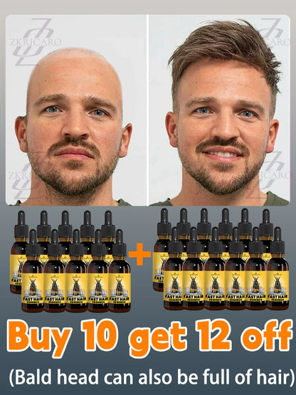 2025 bestseller, Hair growth oil for men, accelerates hair growth, no longer troubled by baldness, increases hair volume