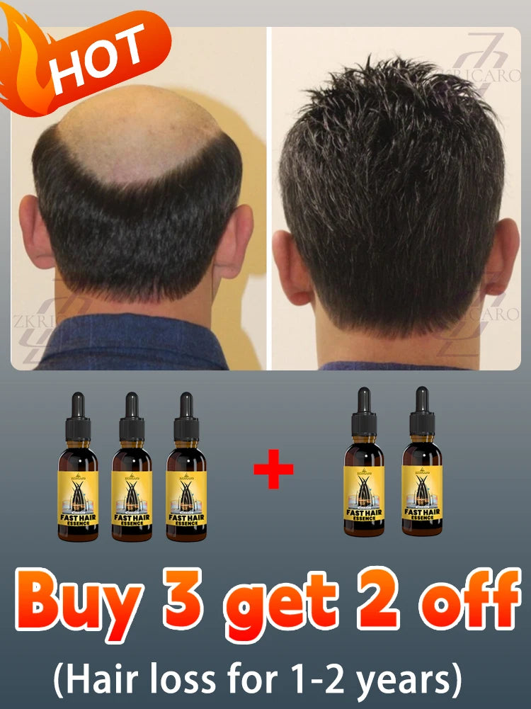 2025 bestseller, Hair growth oil for men, accelerates hair growth, no longer troubled by baldness, increases hair volume
