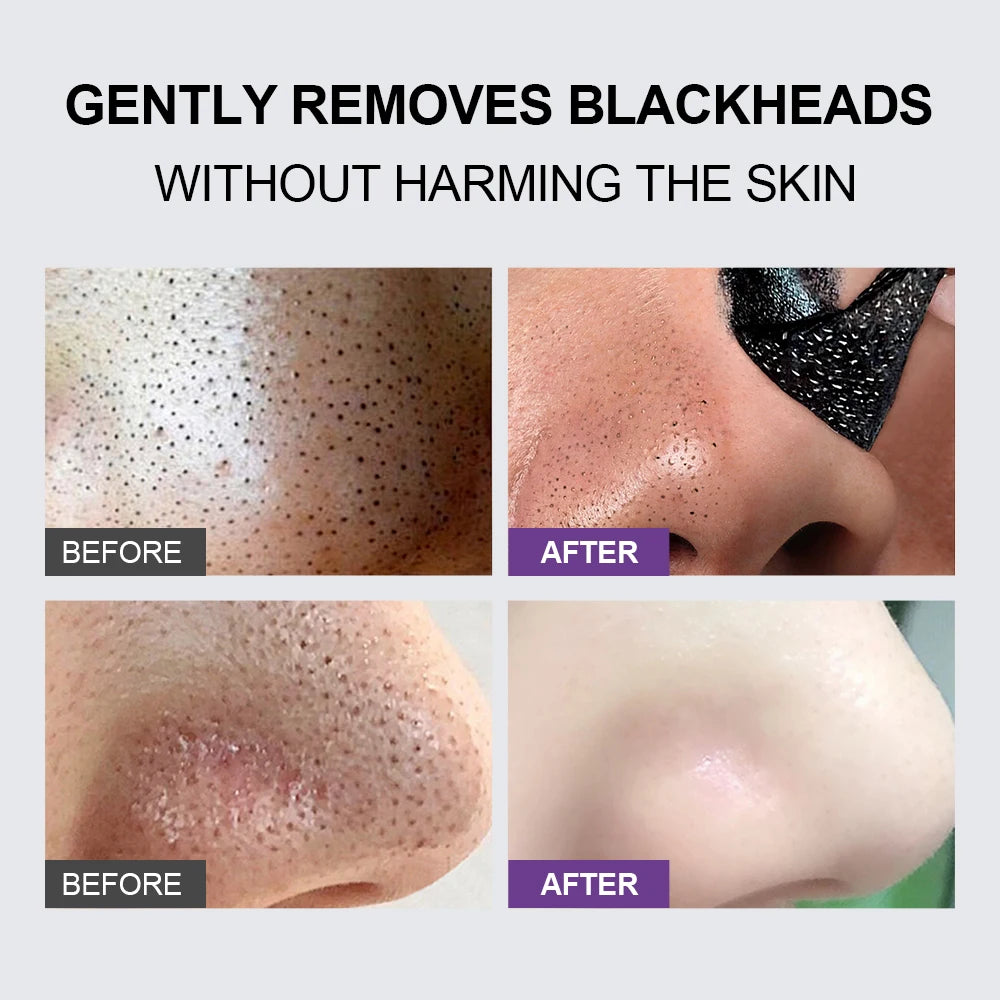 Black Head Remover Face Mask Bamboo Charcoal Black Dot T-zone Deep Cleaning for Women Men Blackhead Facial Skin Care Products