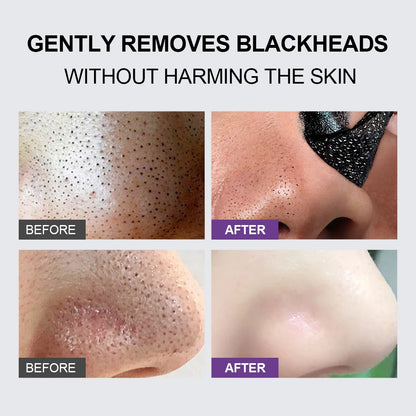 Black Head Remover Face Mask Bamboo Charcoal Black Dot T-zone Deep Cleaning for Women Men Blackhead Facial Skin Care Products