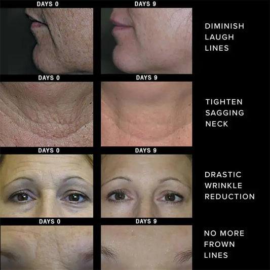 Retinol Cream Tightening Anti Wrinkle Improve Sagging Moisturizing Smoothing Lightening Firming Radiant Fine Lines Removal Cream