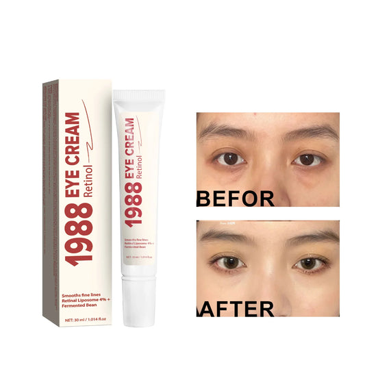 30ML Retinol Eye Cream Reduces Fine Lines And Dark Circles Brightens Skin Around Eyes Deeply Moisturizes Firming Eye Cream