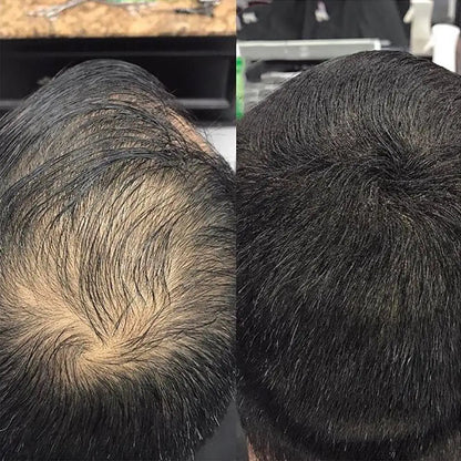 Hair powder Waterproof Hair Shadow Powder Puff Makeup Line Concealer Cover Hair Powder Hair With Hair for men and women