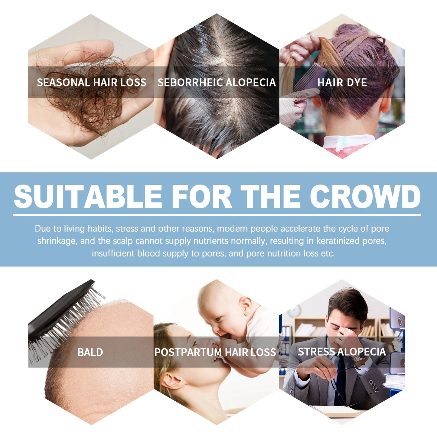 Hair Care Ampoules Prevent Dry Broken Hair Nourish Scalp Hair Follicles Reduce Hair Loss Stabilize Hair Roots Hair Care Essence