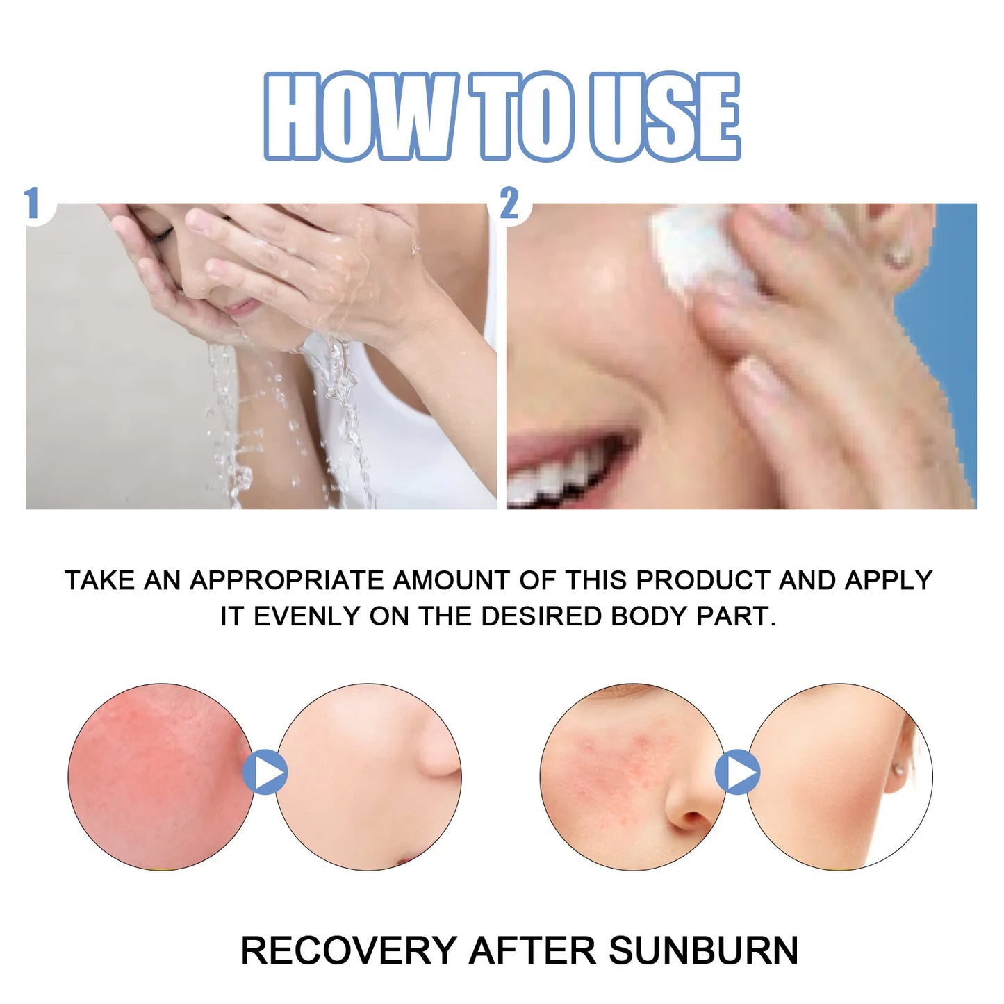 EELHOE After Sun Repair Cream Aloe Vera Sunburn Repair Gel Face Body Refreshing Moisturizing Protection Skin Care Free Shipping