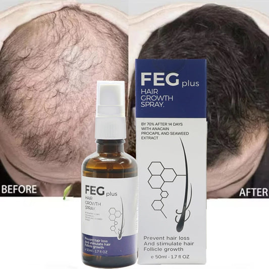 2pcs FEG hair growth spray original Organic Anti Hair Loss Hair Growth Treatment Oil For Thicker Long Hair -50ML