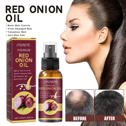 Red Onion Hair Growth Essential Oil Hair Care Spray Prevent Hair Loss Nourish Hair Roots Improve Hair Texture Hair Care Products