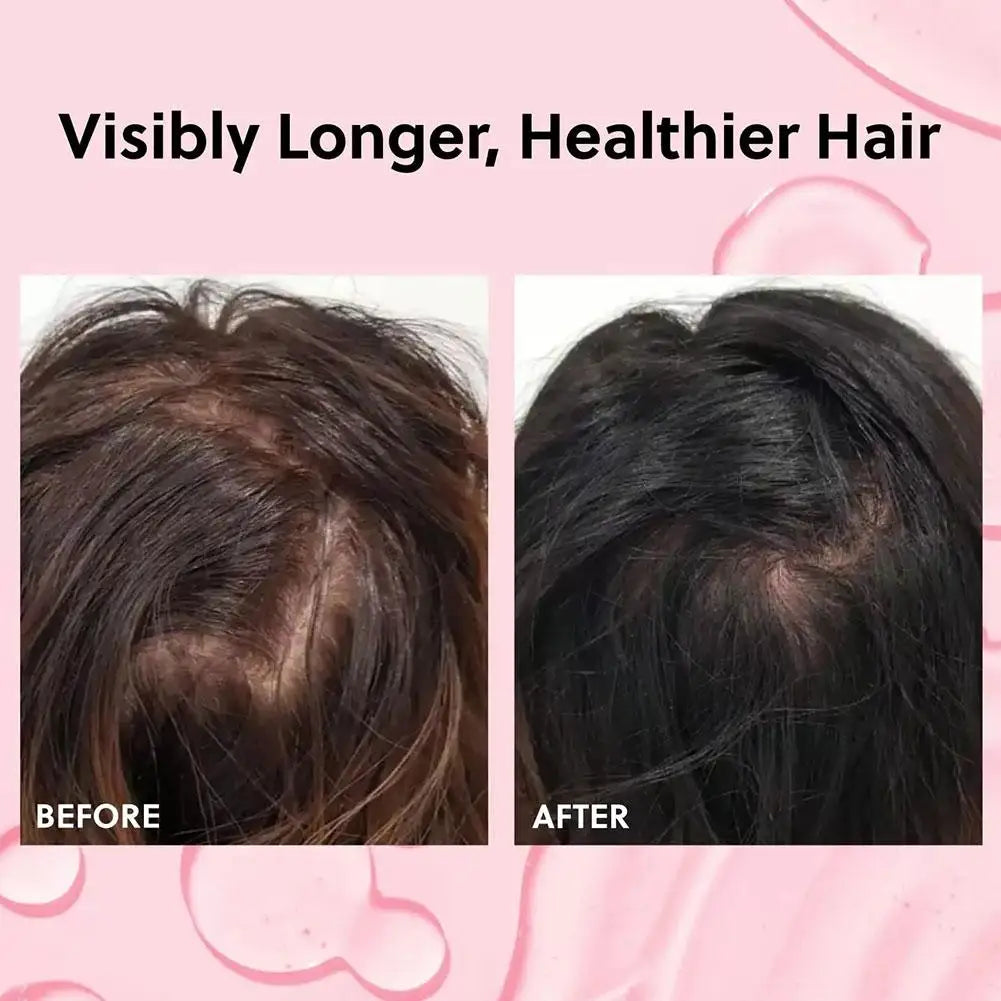 Forchics Anti-Hair Loss Products Hair Growth Natural Essence Spray Repair Damage Frizzy Scalp Hair Root Shiny Essence Hair Care
