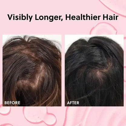 Forchics Anti-Hair Loss Products Hair Growth Natural Essence Spray Repair Damage Frizzy Scalp Hair Root Shiny Essence Hair Care