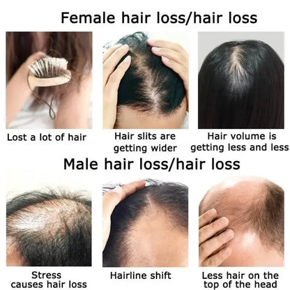 Ginger Hair Growth Essential Oil Herbal Hair Care Anti-Hair Loss Repair Hair Follicles Stimulate Hair Growth