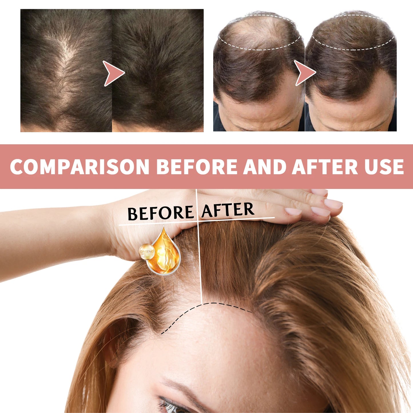Hair Care Ampoules Prevent Dry Broken Hair Nourish Scalp Hair Follicles Reduce Hair Loss Stabilize Hair Roots Hair Care Essence