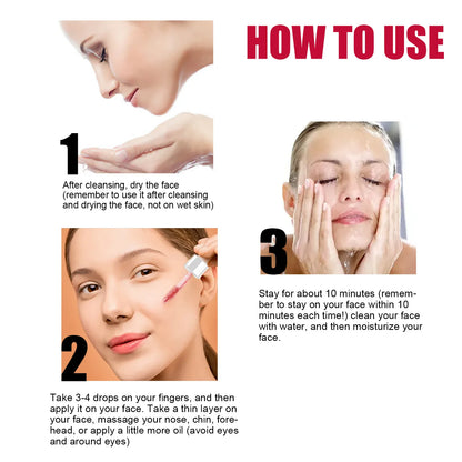 AHA 30%+BHA 2% Exfoliating Face Salicylic Acid Serum Shrink Pores Moisturizing Nourish Smooth Essence Oil Control Skin Care