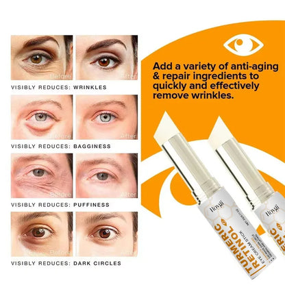 Instant Eye Bag Remove Eye Cream Anti Fat Particles Dark Circles Puffiness Fade Fine Lines Lift Brighten Korean Beauty Eye Care