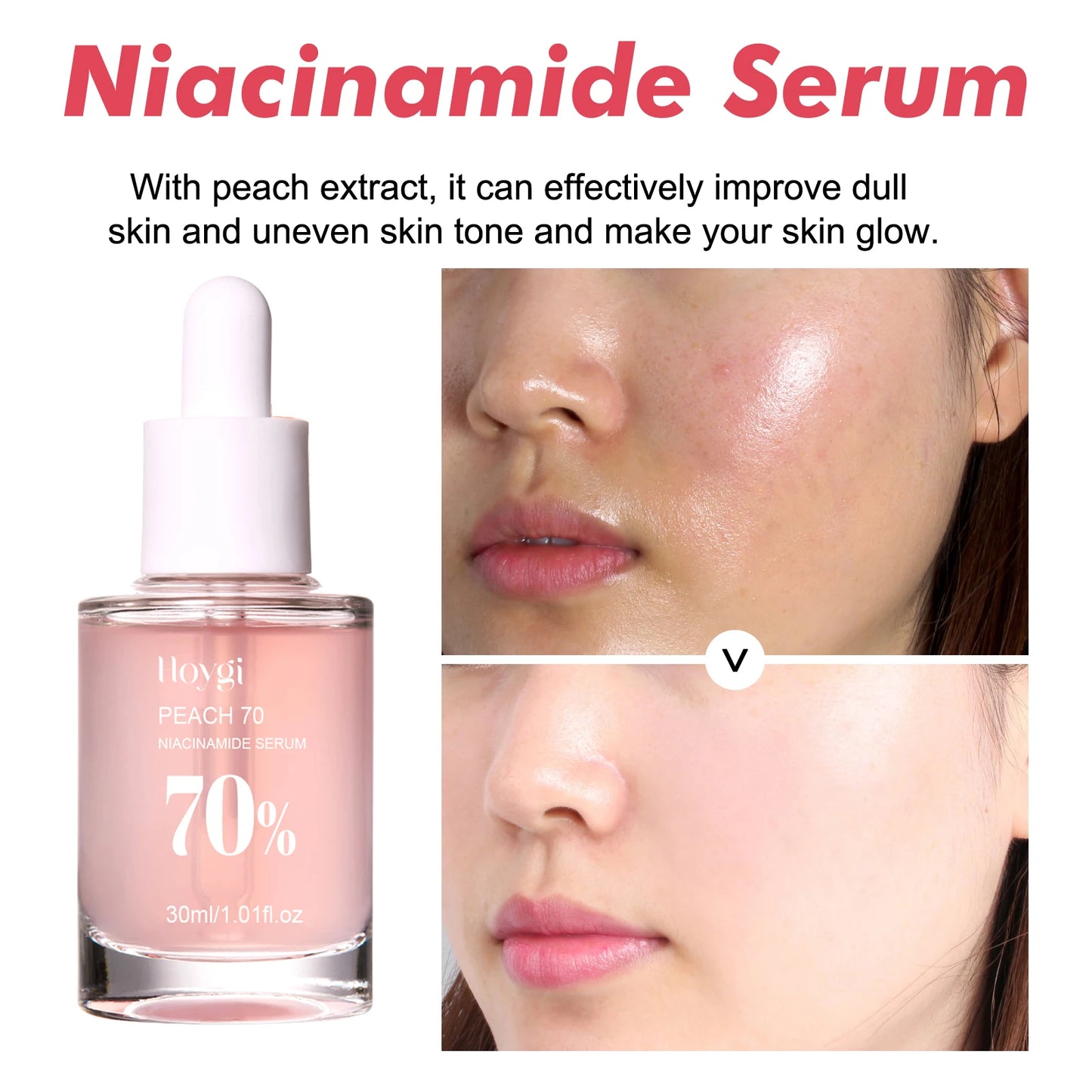 Niacinamide Facial Serum Fade Melanin Moisturzing Rejuvenation Shrink Pores Smooth Brightening Skin Care Dark Spot Remover Serum
