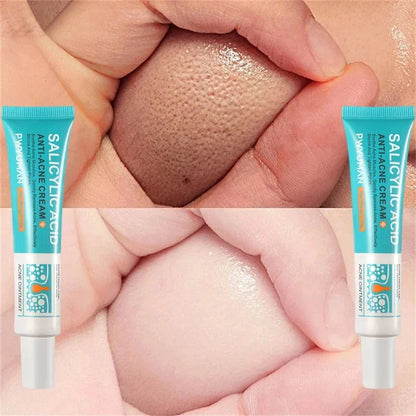 Salicylic Acid Pore Shrinking Cream Quick Eliminate Large Pores Remove Blackehead Tighten Repair Face Smooth Skin Care Products