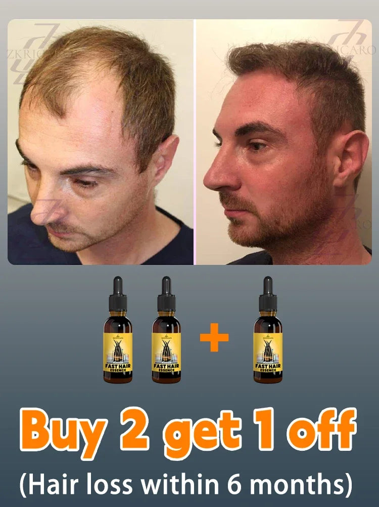2025 Hair growth oil, repair baldness, hairline, rapid hair growth hair growth oil for men