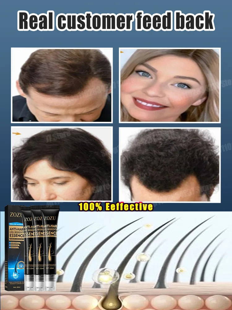 Say Goodbye to Baldness Hair Loss Product Ginger Oil Care Serum Hair Growth for Men Women