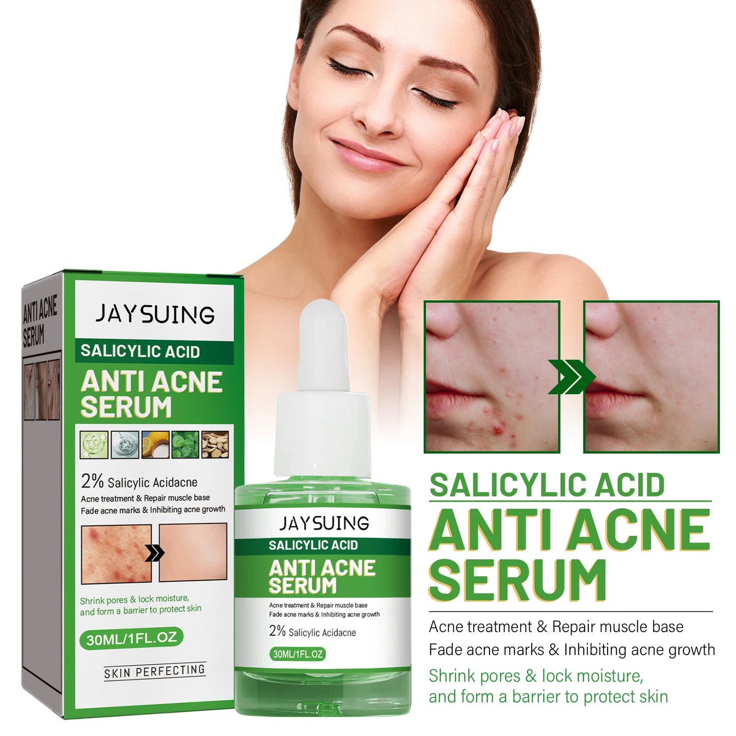 Salicylic Acid Anti Acn-e Serum Essence Controls Oil Shrinks Pores Removes Blackheads & Acne Repairs Acne Marks Moisturizes Face