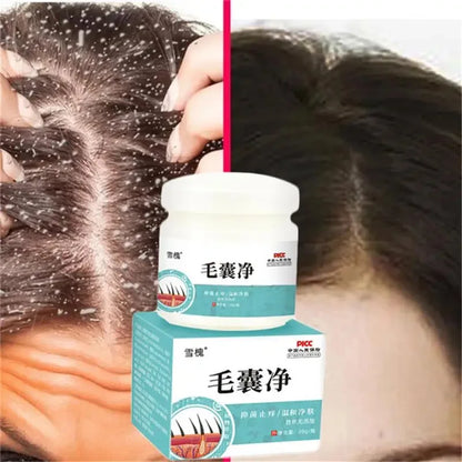 Fast Anti Dandruff Hair Treatment Scrub Itching Repair Scalp Cleaning Exfoliating Products Oil Control Antipruritic Hair Care