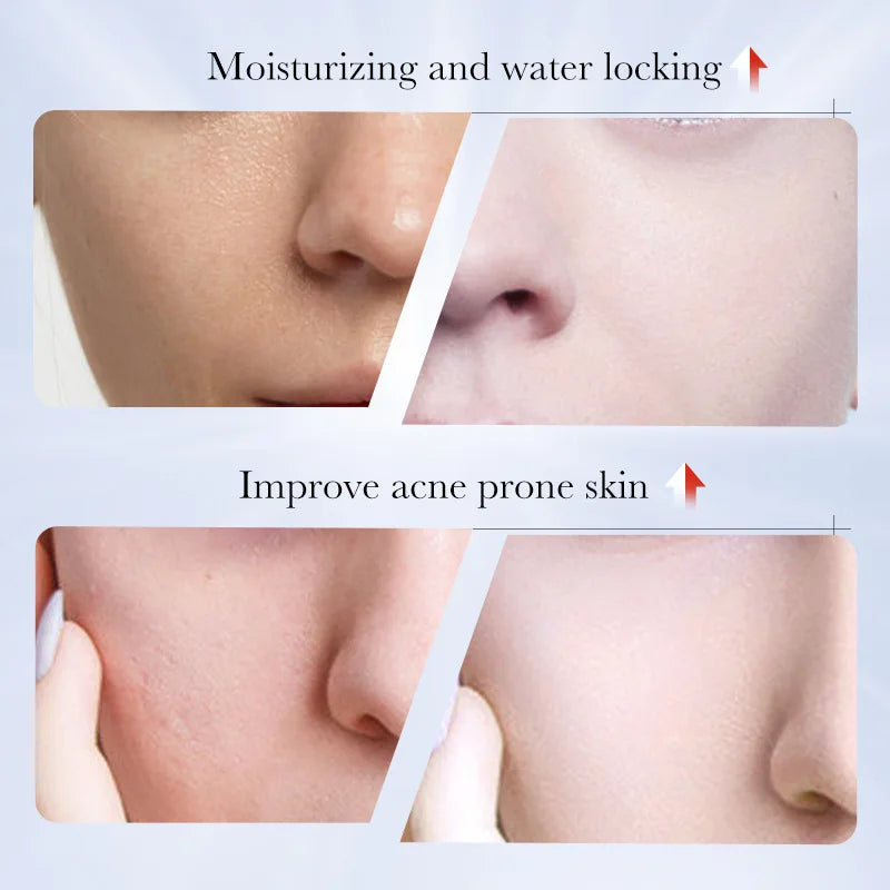 1/2/4pcs SADOER Kojic Acid Face Cream Moisturizing Freckle Removing Creams Brightening Hydrating Facial Cream Skin Care Products