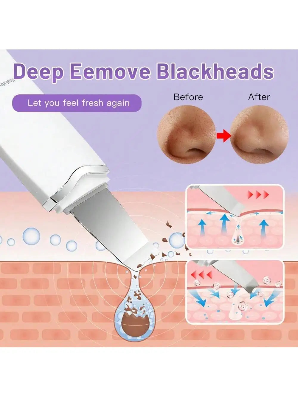 Ultrasonic Skin Scrubber Scrubber Deep Vibrate Facial Cleaner Shovel Face Scrubber Peeling Black Head Remover Facial Massager