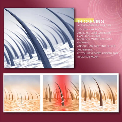 5/3/1pcs Red Onion Essential Oil Spray For Hair Care,Rice Water Moisturizing Hair Spray,Damaged Hair Treatments Hair Care