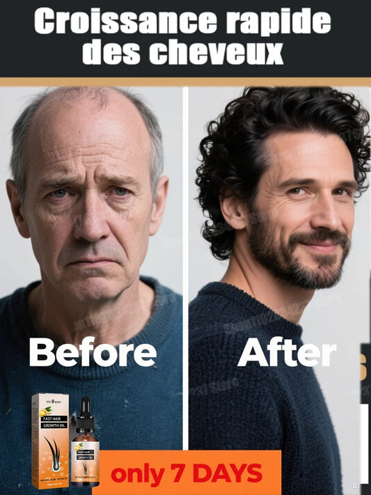 Get Fuller and Healthier Hair with Hair Care Essential Oils - Hot Selling Product