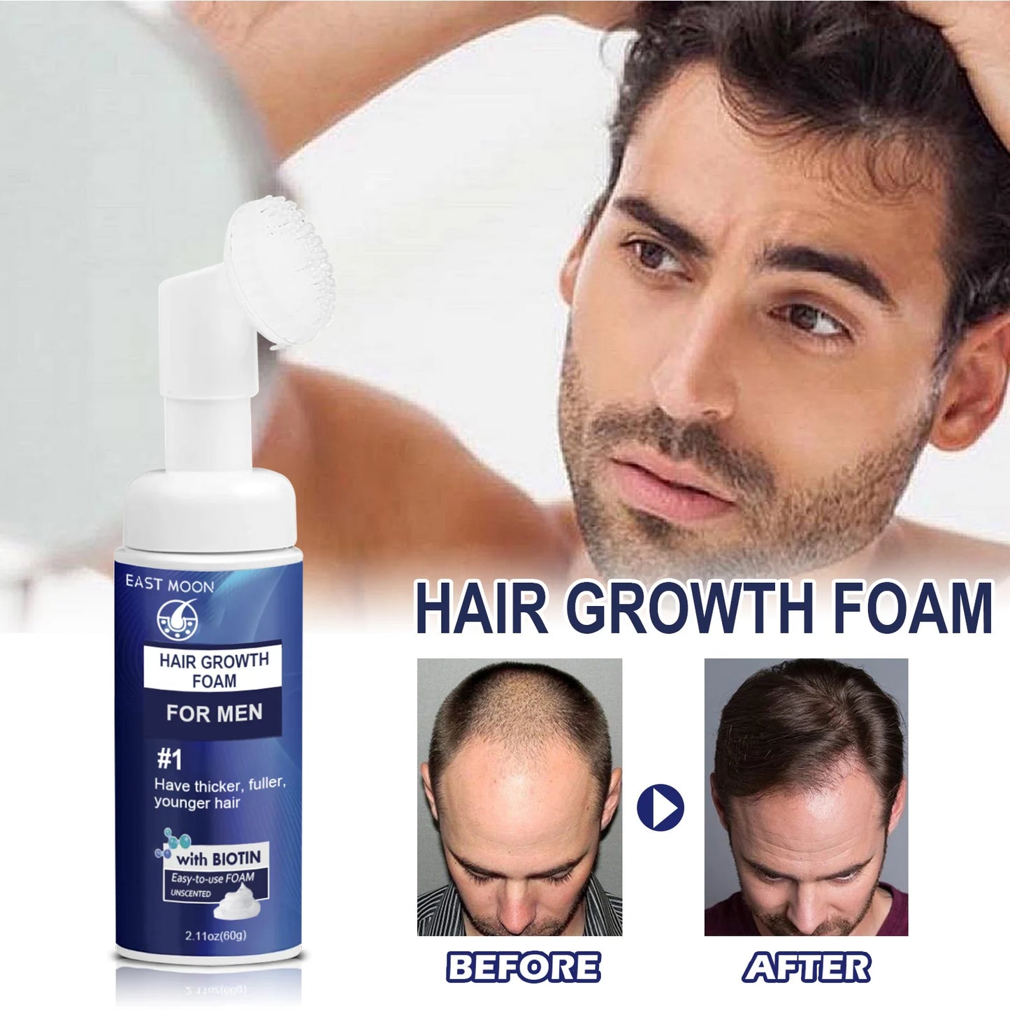 East Moon Natural Hair Growth Foam Thick Hair Care Anti Hair Loss Scalp Care Repair Hair Roots Beauty Health For Men Women