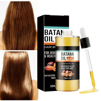 Batana Oil Spray Repairs Baldness Strengthens Hair Natural Nourishment Hereditary Loss Treatment,Moisturizes Scalp All Genders
